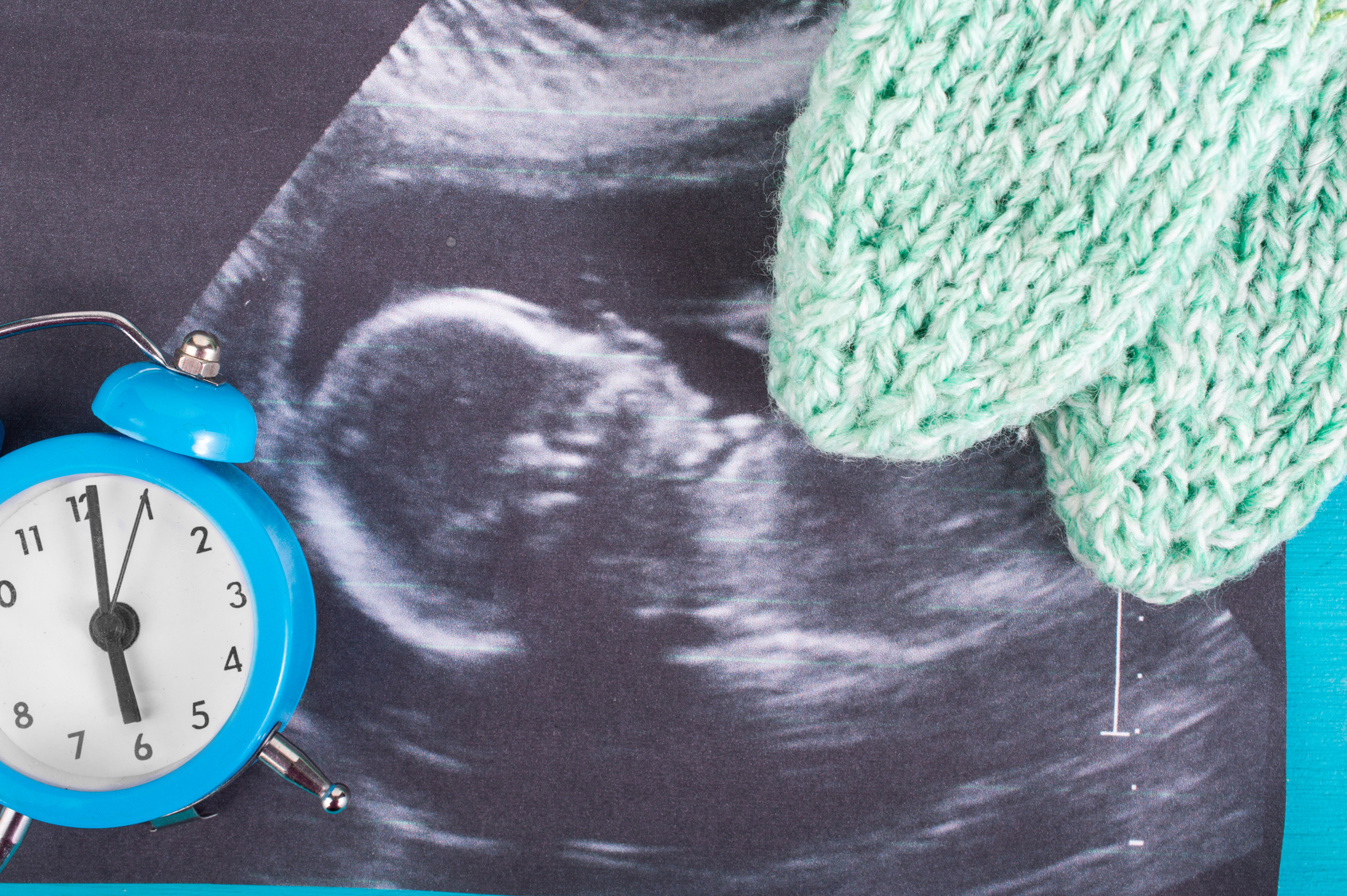 Ordo Iuris na forum ONZ upomina się o prawo do życia niepełnosprawnych dzieci.