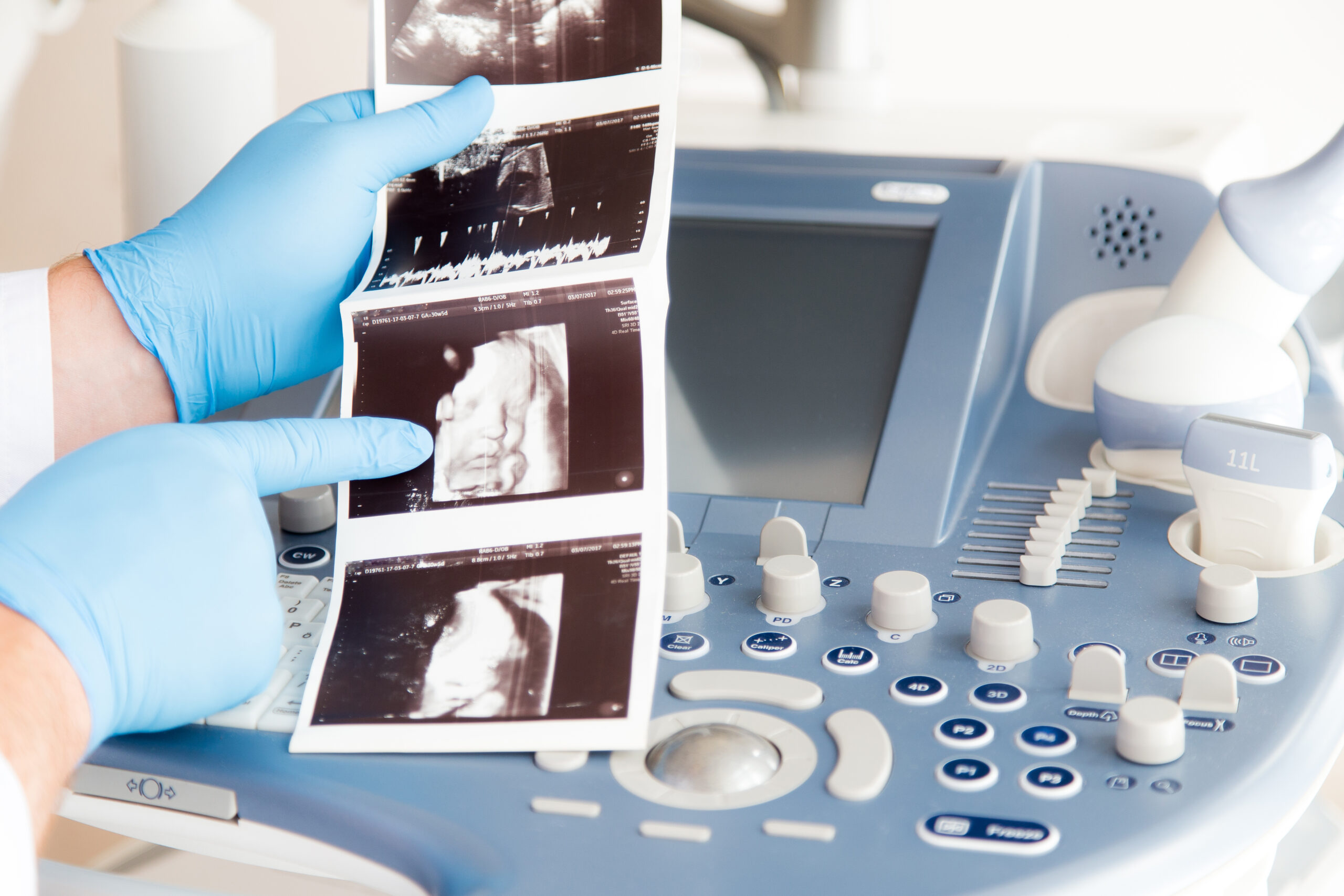 Analiza „Wytycznych w sprawie obowiązujących przepisów prawnych dotyczących dostępu do procedury przerywania ciąży”