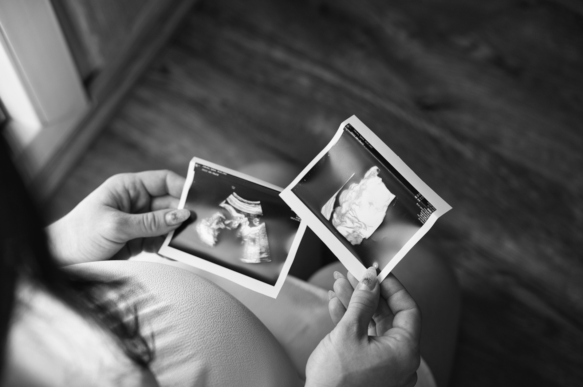 Number of Children Dying in Polish Hospitals Is Rising Rapidly — Mainly Due to Abortions for “Psychological Reasons”